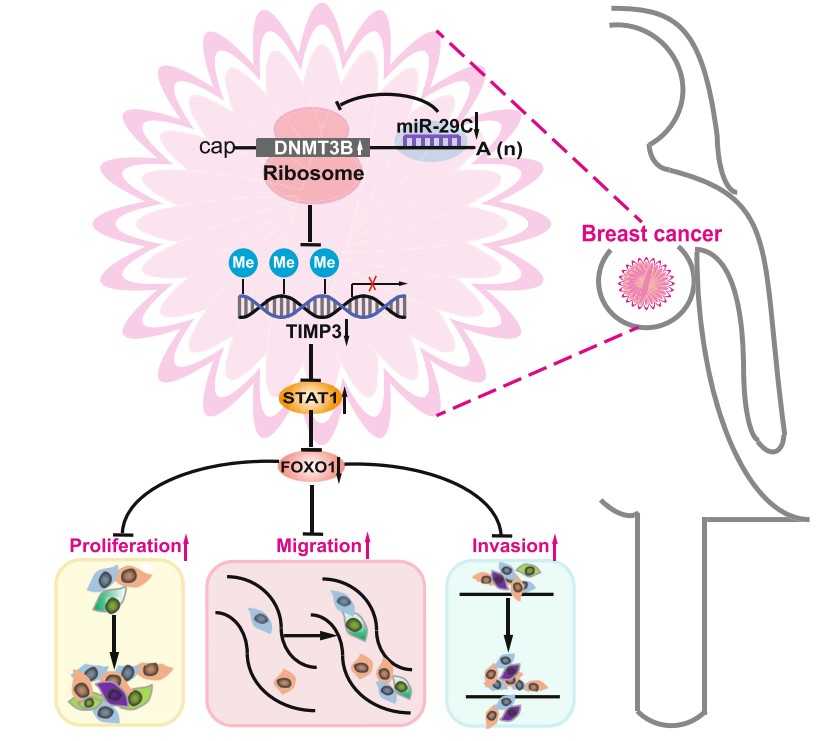 Proposed mechanistic scheme miR-29c suppresses breast cancer by the TIMP3 pathway.jpg